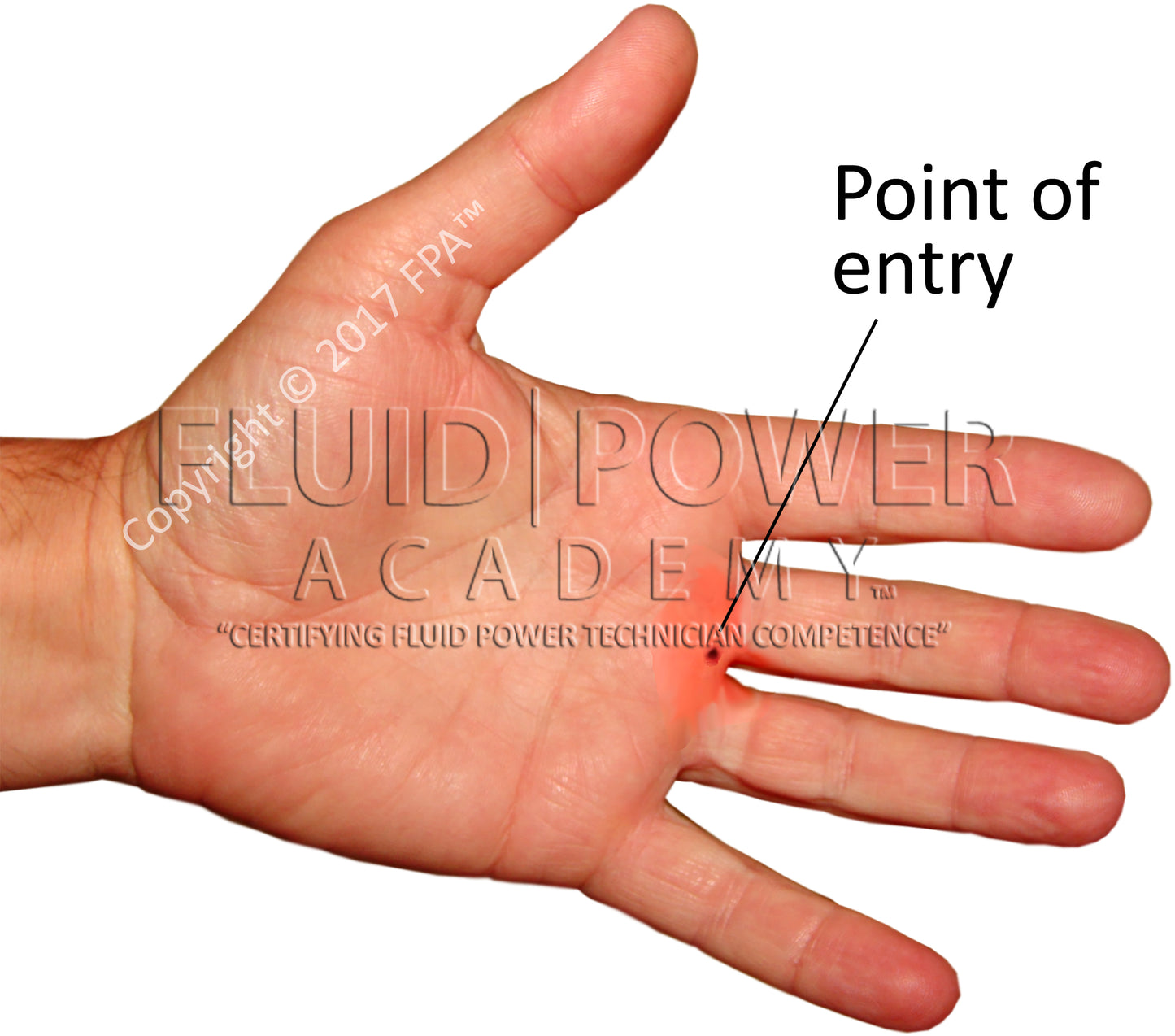 (202030) Hydraulic Injury Bundle (6 images)