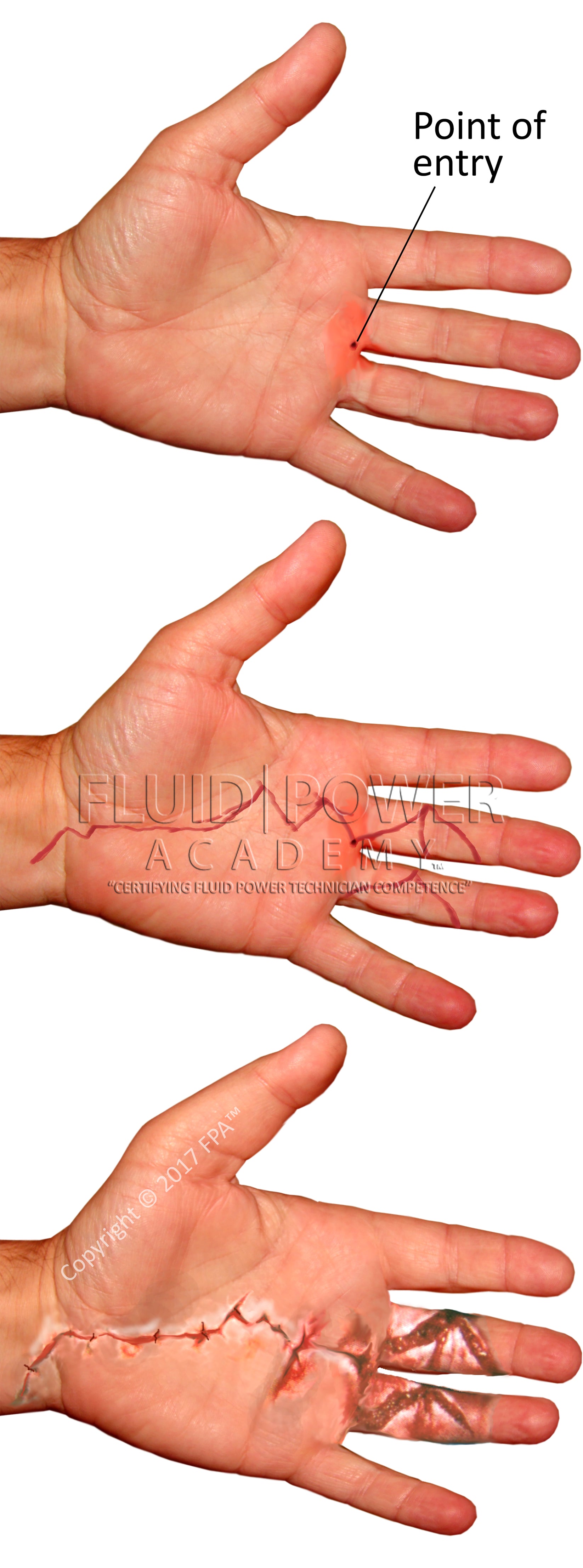 (202030) Hydraulic Injury Bundle (6 images) Fluid Power Academy