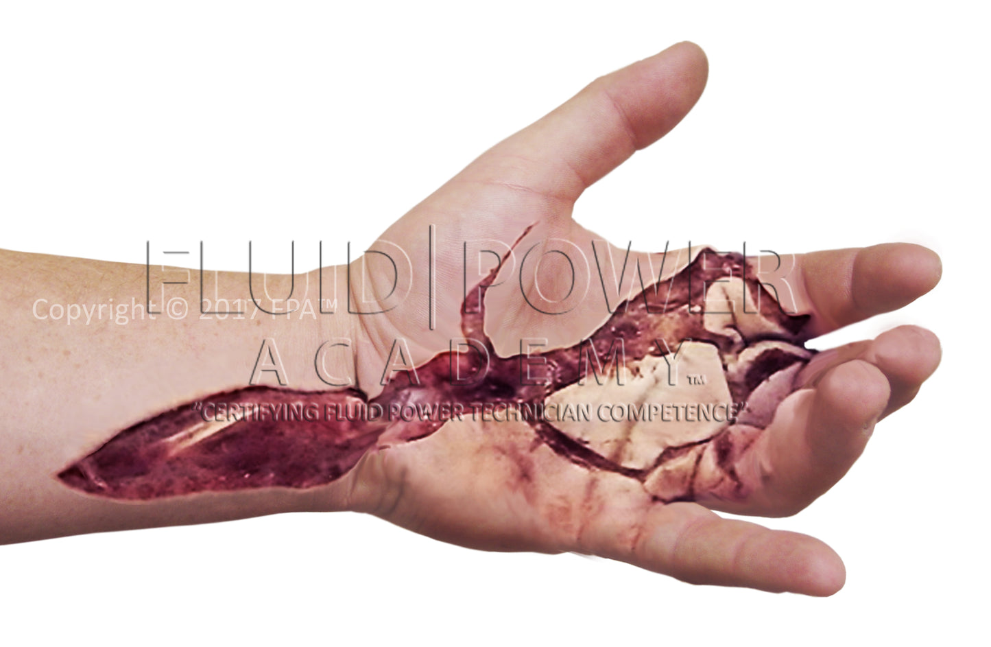 (202030) Hydraulic Injury Bundle (6 images)