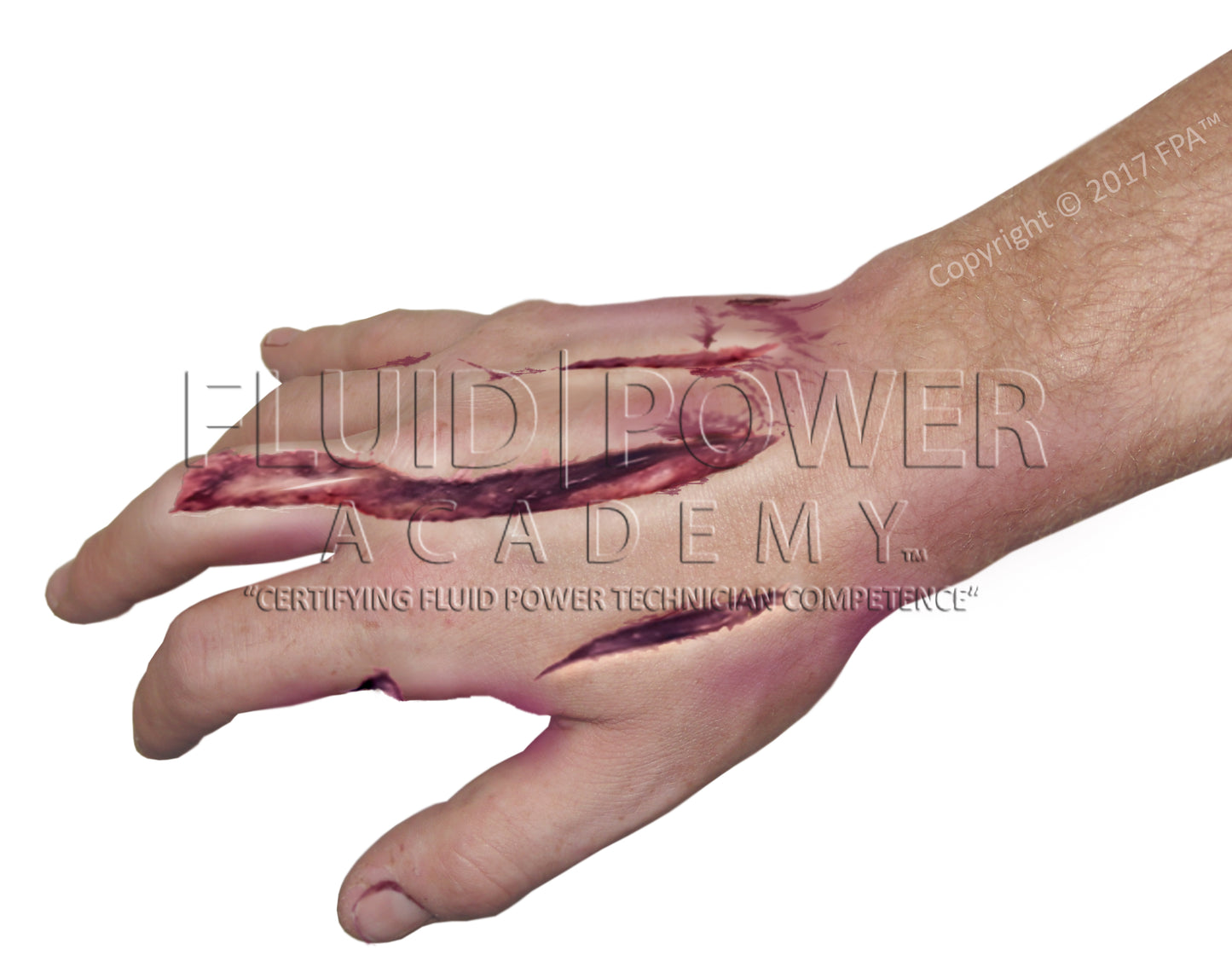 (202030) Hydraulic Injury Bundle (6 images)